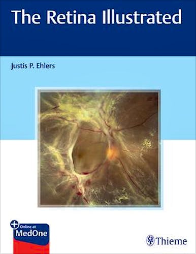 Portada del libro 9781626238312 The Retina Illustrated + Online at MedOne
