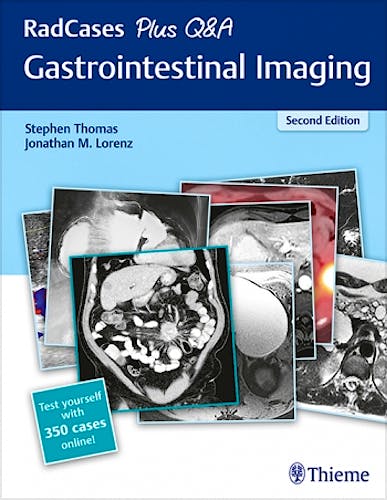 Portada del libro 9781626238688 Gastrointestinal Imaging (RadCases Plus Q&A)