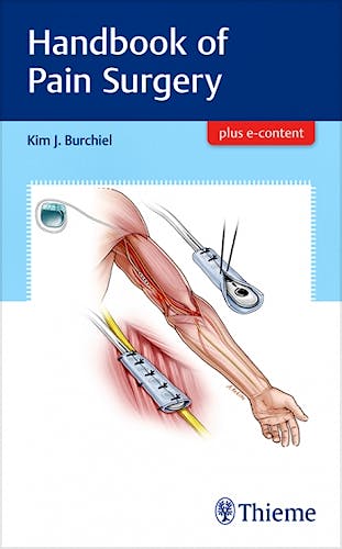 Portada del libro 9781626238718 Handbook of Pain Surgery + E-Content