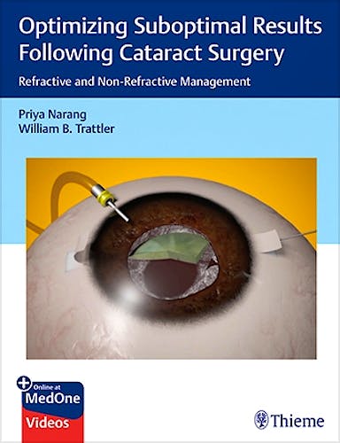 Portada del libro 9781626238954 Optimizing Suboptimal Results Following Cataract Surgery. Refractive and Non-Refractive Management