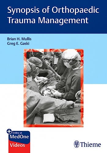Portada del libro 9781626239180 Synopsis of Orthopaedic Trauma Management