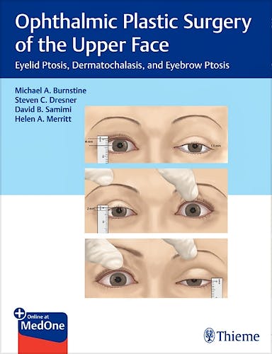 Portada del libro 9781626239210 Ophthalmic Plastic Surgery of the Upper Face. Eyelid Ptosis, Dermatochalasis, and Eyebrow Ptosis