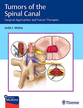Portada del libro 9781626239319 Tumors of the Spinal Canal. Surgical Approaches and Future Therapies