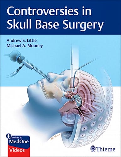 Portada del libro 9781626239531 Controversies in Skull Base Surgery