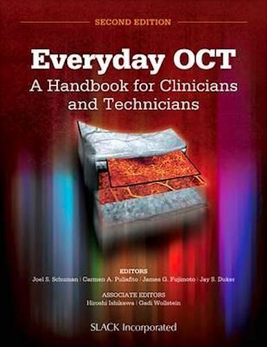 Portada del libro 9781630911720 Everyday Oct. a Handbook for Clinicians and Technicians