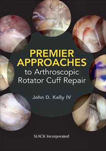 Portada del libro 9781630915629 Premier Approaches to Arthroscopic Rotator Cuff Repair