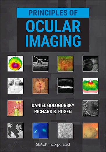 Portada del libro 9781630915995 Principles of Ocular Imaging