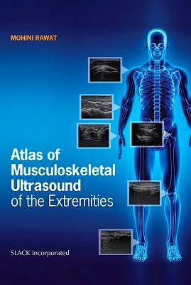 Portada del libro 9781630916022 Atlas of Musculoskeletal Ultrasound of the Extremities