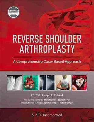 Portada del libro 9781630916855 Reverse Shoulder Arthroplasty. A Comprehensive Case-Based Approach