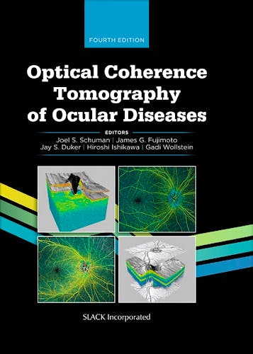 Portada del libro 9781630917081 Optical Coherence Tomography of Ocular Diseases
