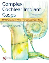 Portada del libro 9781635503838 Complex Cochlear Implant Cases. Management and Troubleshooting