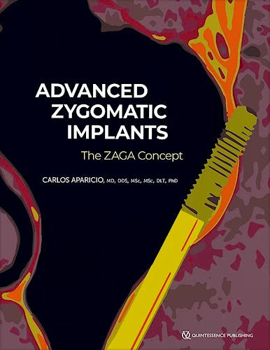 Portada del libro 9781647241698 Advanced Zygomatic Implants. The ZAGA Concept