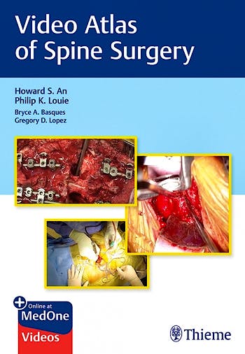 Portada del libro 9781684200054 Video Atlas of Spine Surgery