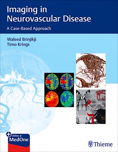 Portada del libro 9781684200535 Imaging in Neurovascular Disease. A Case-Based Approach