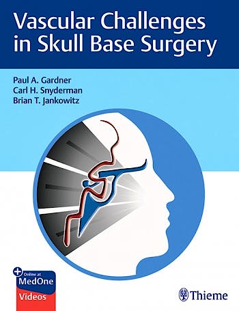 Portada del libro 9781684200689 Vascular Challenges in Skull Base Surgery