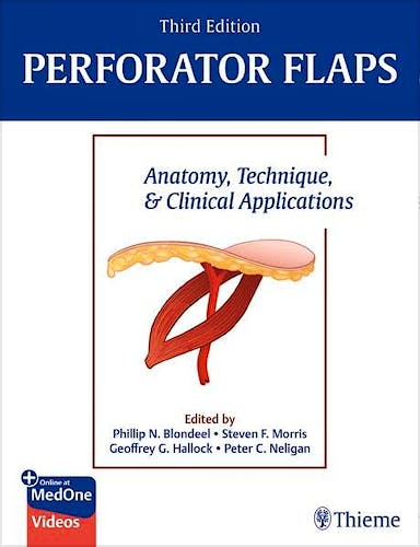 Portada del libro 9781684200726 Perforator Flaps. Anatomy, Technique, and Clinical Applications