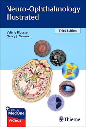 Portada del libro 9781684200740 Neuro-Ophthalmology Illustrated