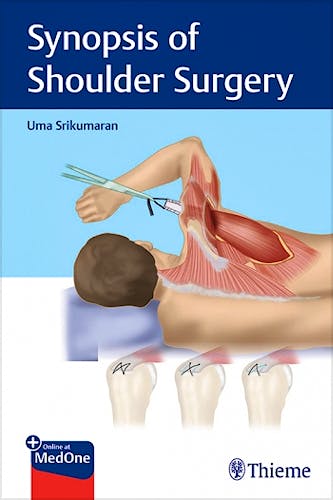 Portada del libro 9781684200801 Synopsis of Shoulder Surgery