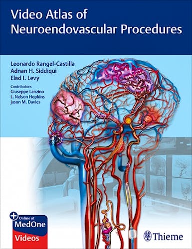 Portada del libro 9781684201181 Video Atlas of Neuroendovascular Procedures