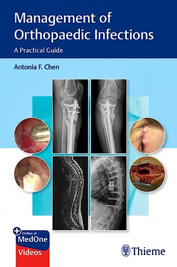 Portada del libro 9781684201334 Management of Orthopaedic Infections. A Practical Guide