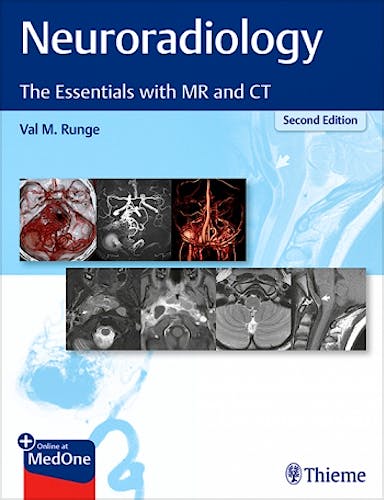 Portada del libro 9781684201532 Neuroradiology. The Essentials with MR and CT
