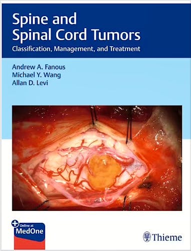 Portada del libro 9781684201631 Spine and Spinal Cord Tumors. Classification, Management, and Treatment