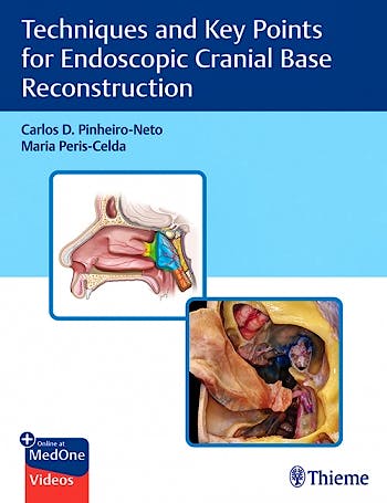 Portada del libro 9781684202324 Techniques and Key Points for Endoscopic Cranial Base Reconstruction