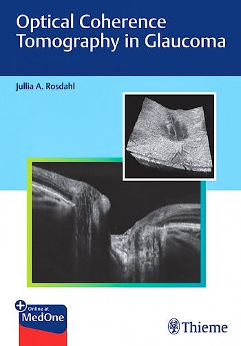 Portada del libro 9781684202478 Optical Coherence Tomography in Glaucoma