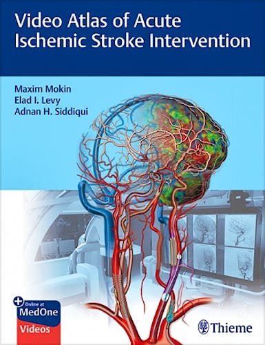 Portada del libro 9781684202492 Video Atlas of Acute Ischemic Stroke Intervention