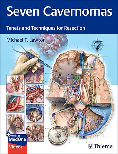 Portada del libro 9781684204946 Seven Cavernomas. Tenets and Techniques for Resection