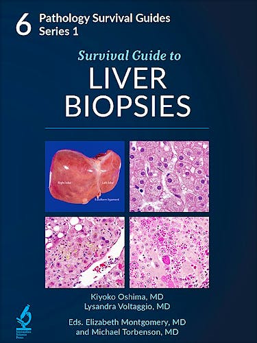 Portada del libro 9781734491623 Survival Guide to Liver Biopsies (Pathology Survival Guides Series 1, Vol. 6)