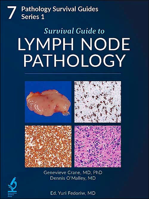 Portada del libro 9781734491654 Survival Guide to Lymph Node Pathology (Pathology Survival Guides Series 1, Vol. 7)