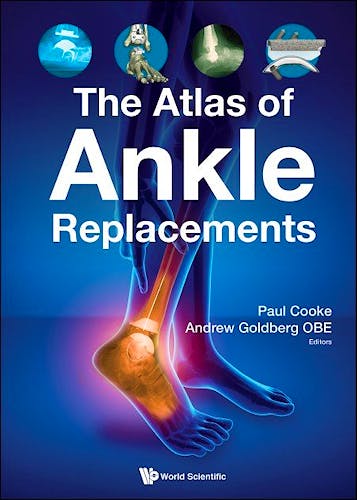 Portada del libro 9781786349712 The Atlas of Ankle Replacements