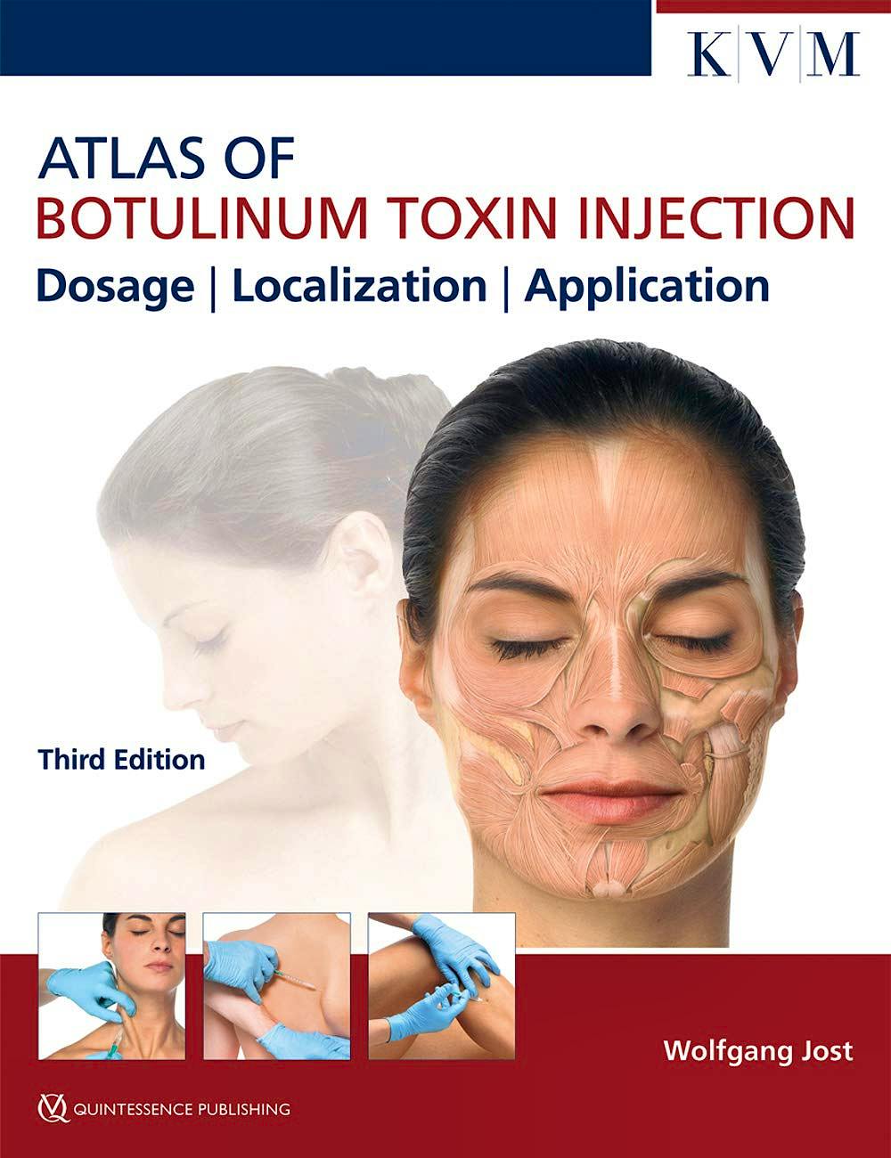 Portada del libro 9781786980304 Atlas of Botulinum Toxin Injection. Dosage, Localization, Application