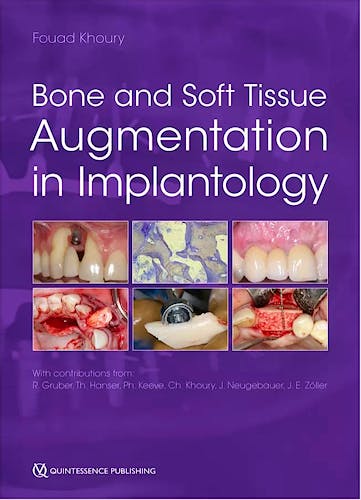 Portada del libro 9781786981042 Bone and Soft Tissue Augmentation in Implantology