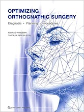 Portada del libro 9781786981219 Optimizing Orthognathic Surgery. Diagnosis, Planning, Procedures