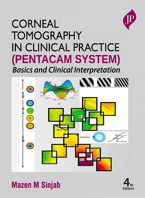 Portada del libro 9781787791619 Corneal Tomography in Clinical Practice (Pentacam System). Basics and Clinical Interpretation