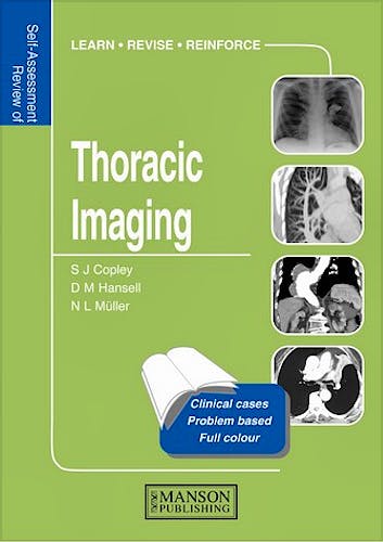 Portada del libro 9781840760620 Thoracic Imaging. Self-Assessment Colour Review