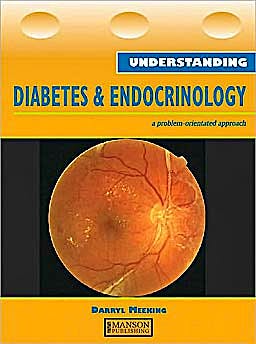 Portada del libro 9781840761009 Understanding Diabetes and Endocrinology. a Problem-Orientated Approach