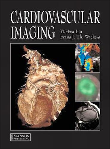 Portada del libro 9781840761092 Cardiovascular Imaging (Hardcover)