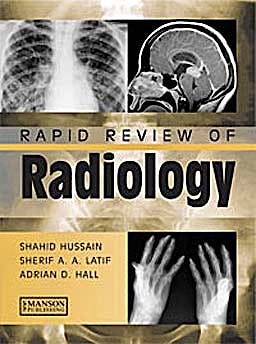 Portada del libro 9781840761207 Rapid Review of Radiology