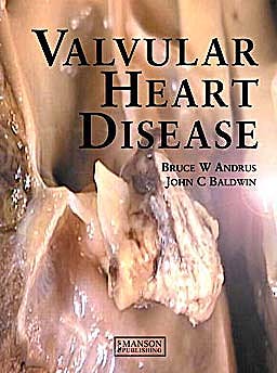 Portada del libro 9781840761368 Valvular Heart Disease