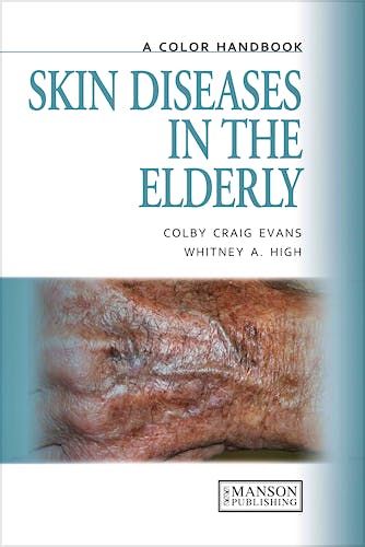 Portada del libro 9781840761542 Skin Diseases in the Elderly. a Color Handbook