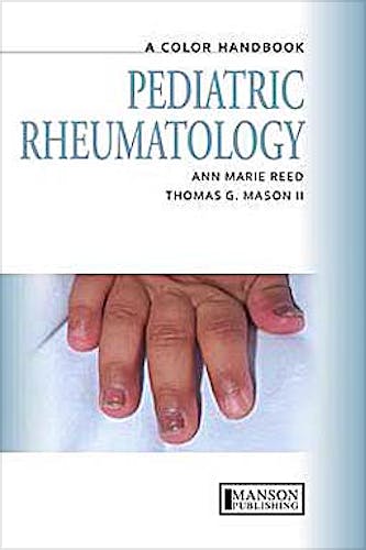 Portada del libro 9781840761573 Pediatric Rheumatology. a Color Handbook