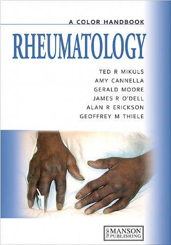 Portada del libro 9781840761733 Reumathology. a Color Handbook