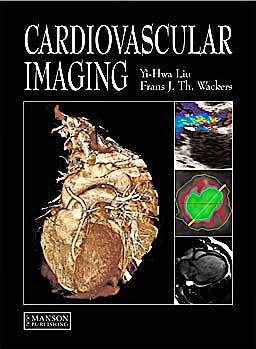 Portada del libro 9781840761917 Cardiovascular Imaging (Softcover)