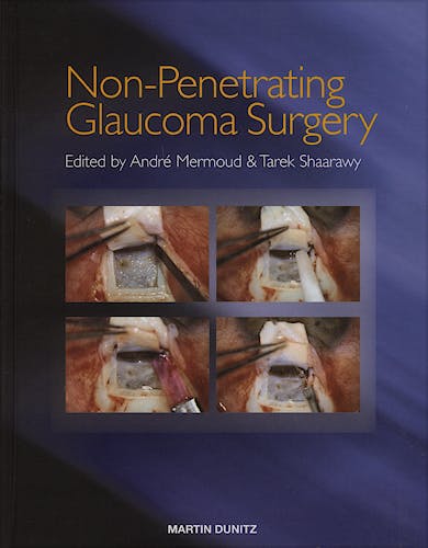 Portada del libro 9781841840420 Non-Penetrating Glaucoma Surgery