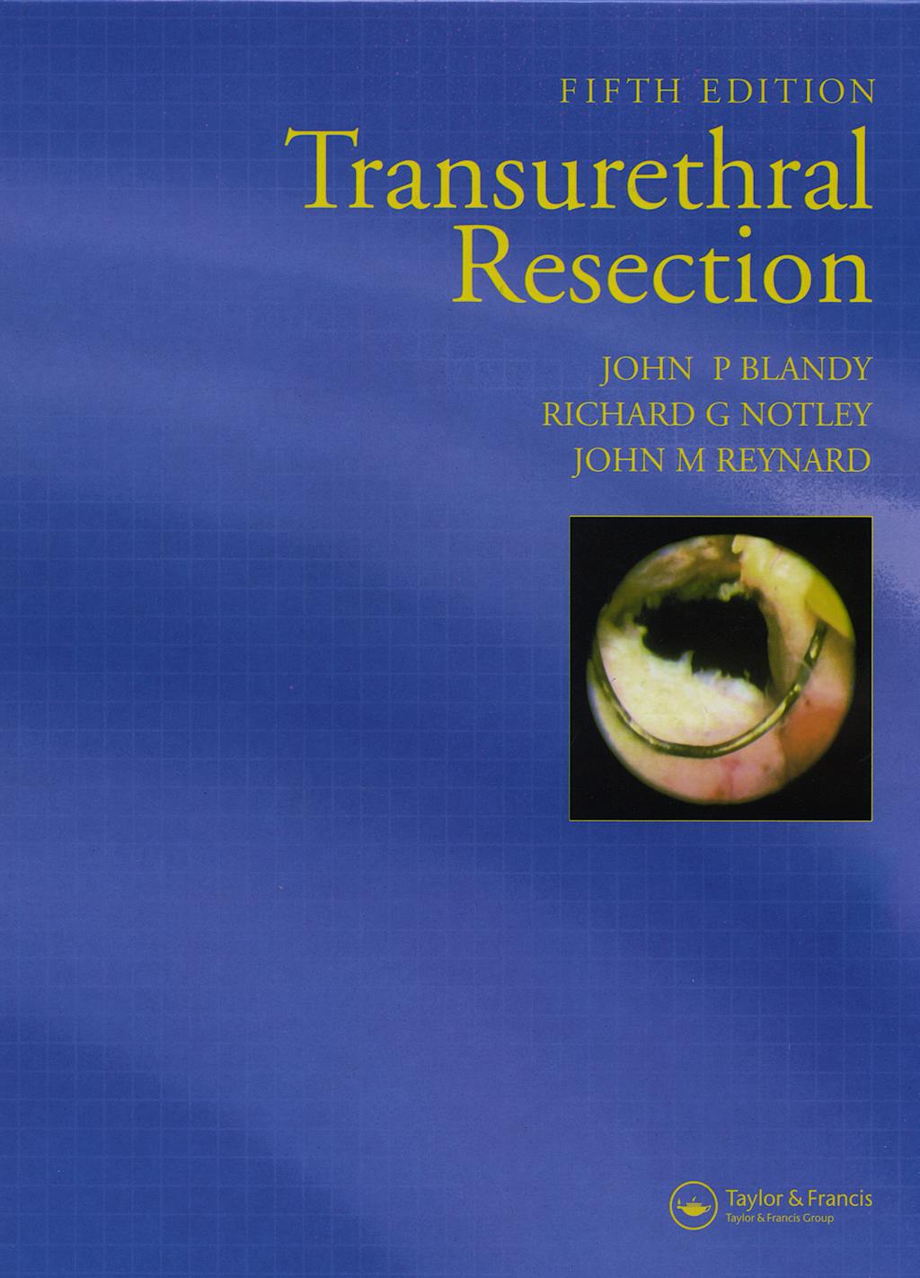 Portada del libro 9781841844084 Transurethral Resection