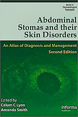 Portada del libro 9781841844312 Abdominal Stomas and Their Skin Disorders. an Atlas of Diagnosis and Management