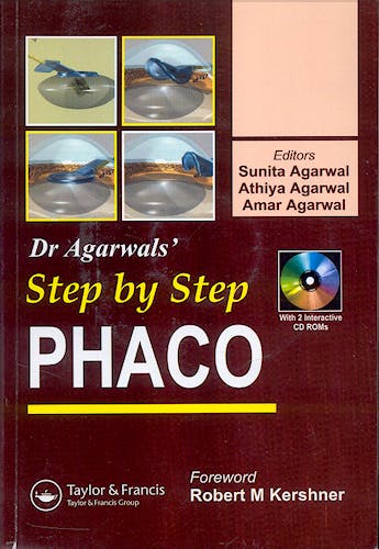 Portada del libro 9781841845494 Dr. Agarwals' Step by Step Phaco